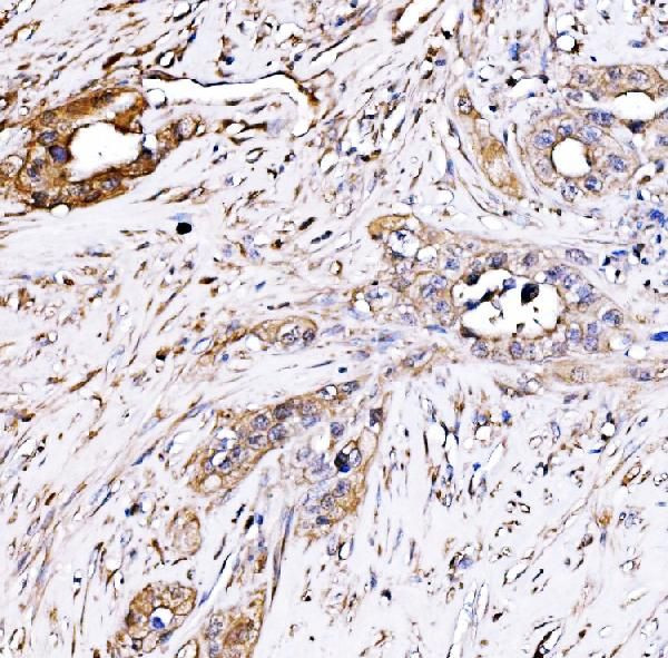 PAK2 Antibody in Immunohistochemistry (Paraffin) (IHC (P))