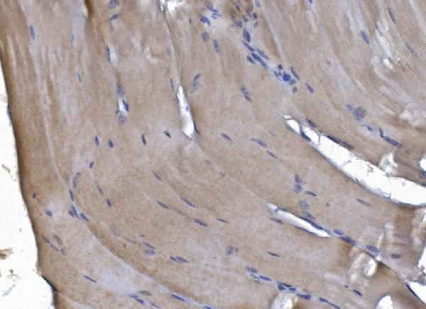 PAK2 Antibody in Immunohistochemistry (Paraffin) (IHC (P))