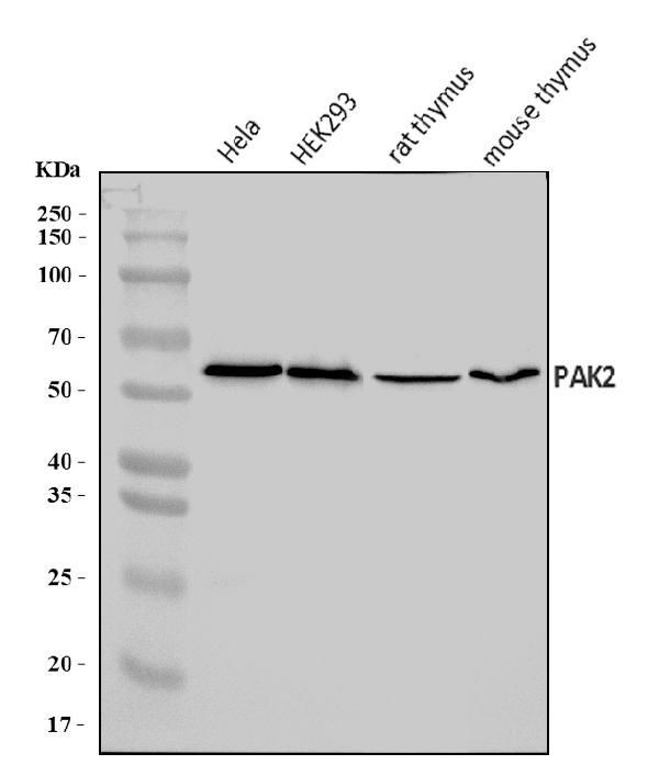 PAK2 Antibody in Western Blot (WB)