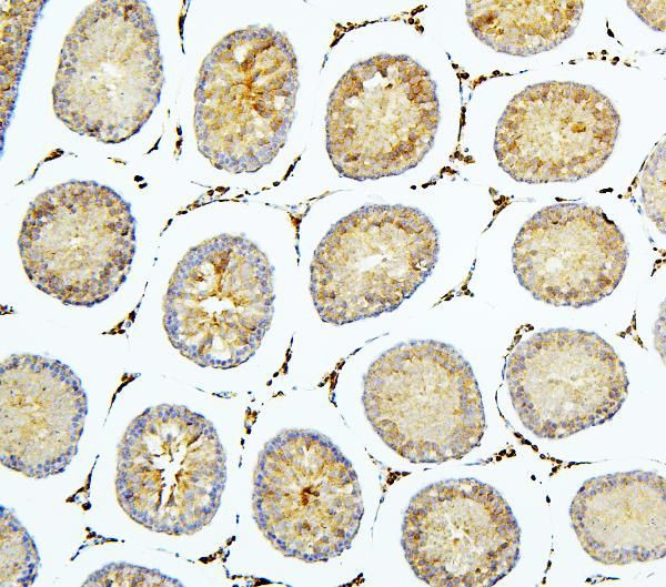 BUBR1 Antibody in Immunohistochemistry (Paraffin) (IHC (P))