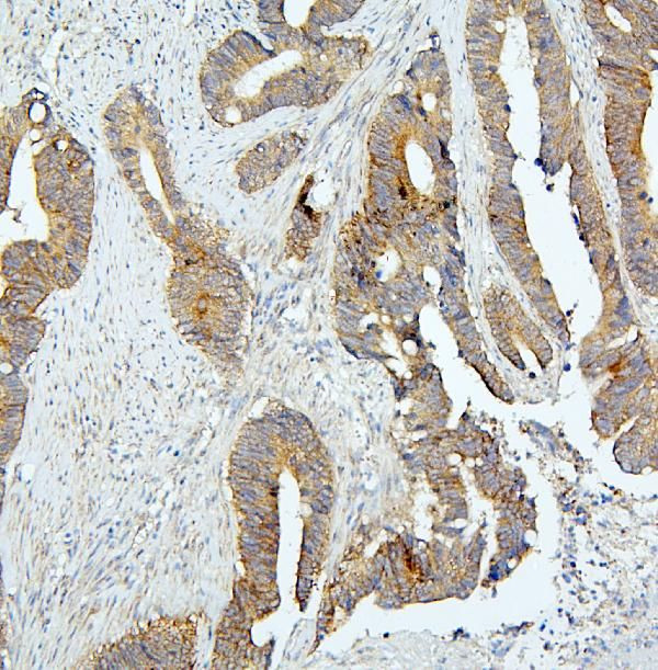 BUBR1 Antibody in Immunohistochemistry (Paraffin) (IHC (P))