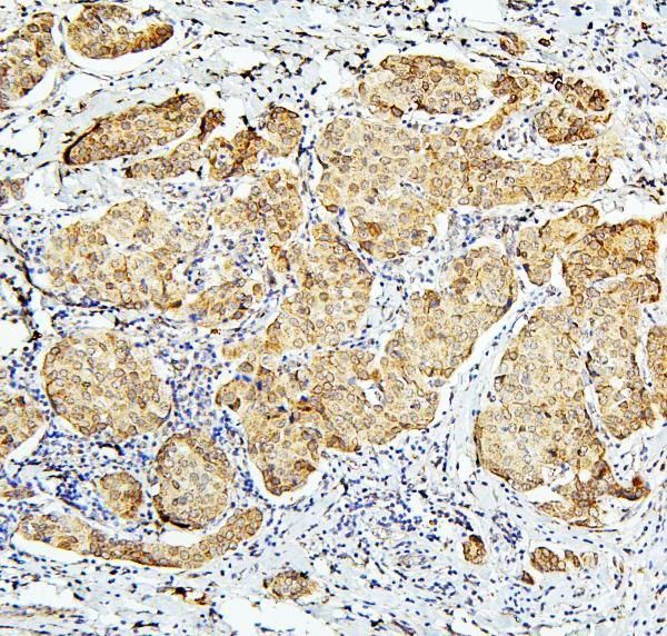 BUBR1 Antibody in Immunohistochemistry (Paraffin) (IHC (P))