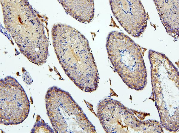 BUBR1 Antibody in Immunohistochemistry (Paraffin) (IHC (P))