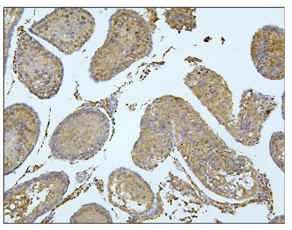 BUBR1 Antibody in Immunohistochemistry (Paraffin) (IHC (P))