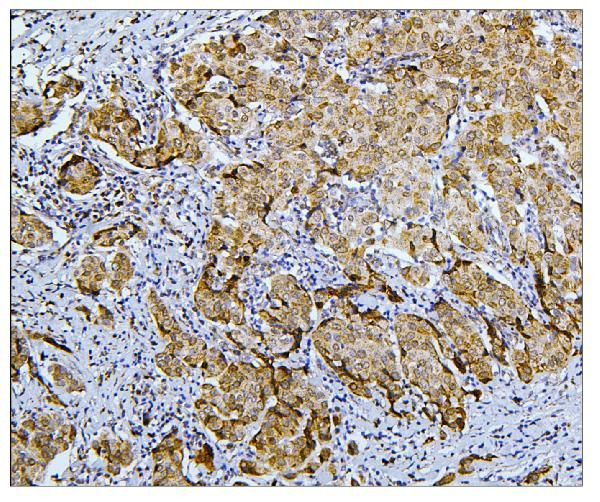 BUBR1 Antibody in Immunohistochemistry (Paraffin) (IHC (P))