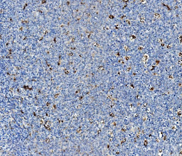 NPC2 Antibody in Immunohistochemistry (Paraffin) (IHC (P))