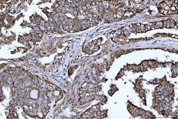 HBEGF Antibody in Immunohistochemistry (Paraffin) (IHC (P))