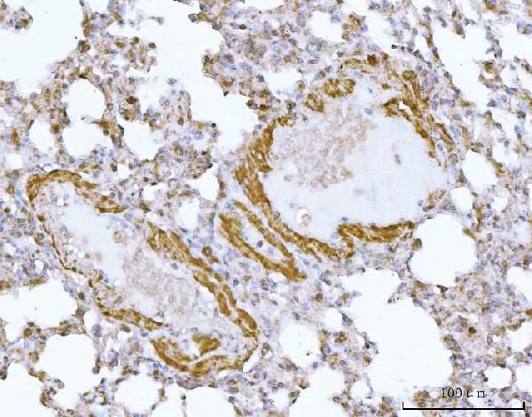 HBEGF Antibody in Immunohistochemistry (Paraffin) (IHC (P))