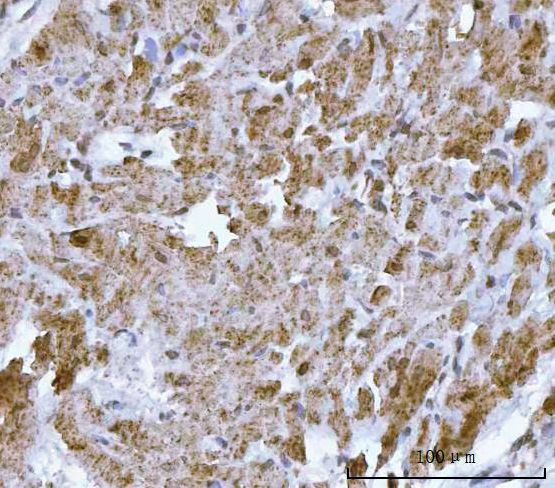 HBEGF Antibody in Immunohistochemistry (Paraffin) (IHC (P))