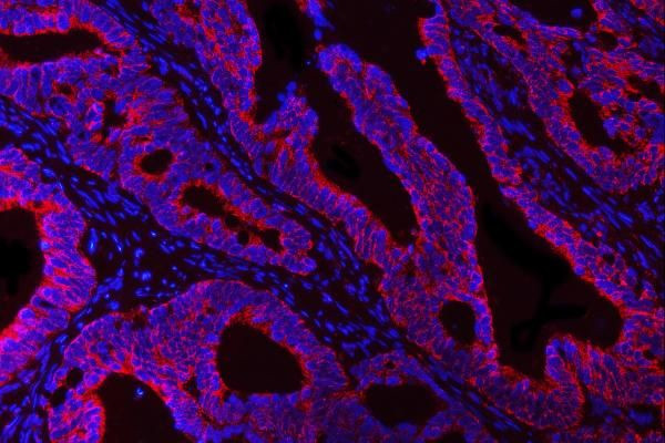 HBEGF Antibody in Immunohistochemistry (Paraffin) (IHC (P))