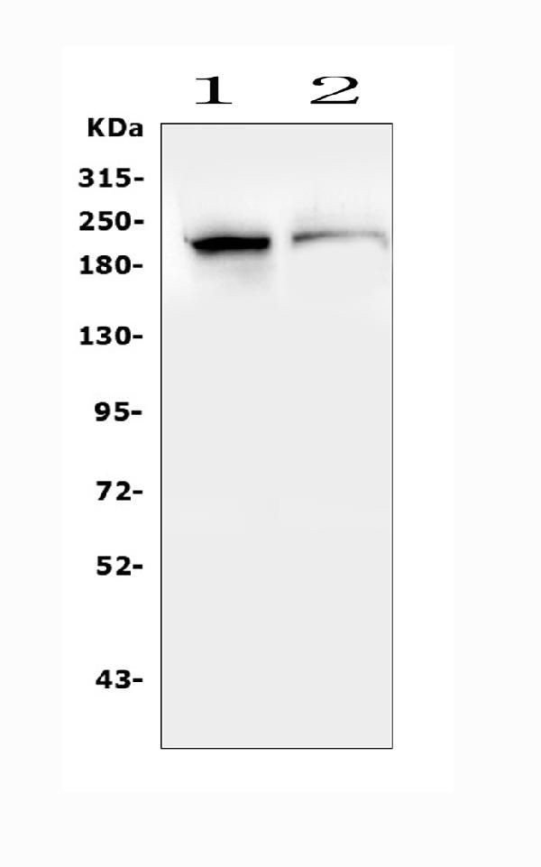 SMARCA2 Antibody in Western Blot (WB)