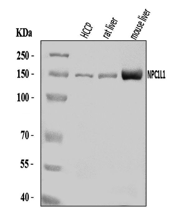 NPC1L1 Antibody in Western Blot (WB)