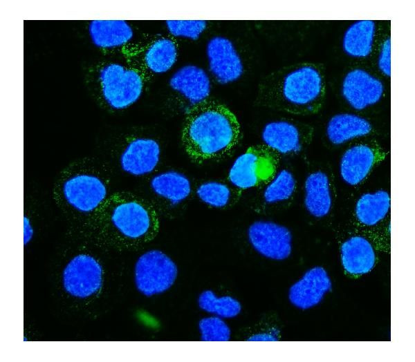 CALM Antibody in Immunocytochemistry (ICC/IF)