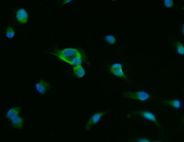 Prostate Specific Acid Phosphatase Antibody in Immunocytochemistry (ICC/IF)