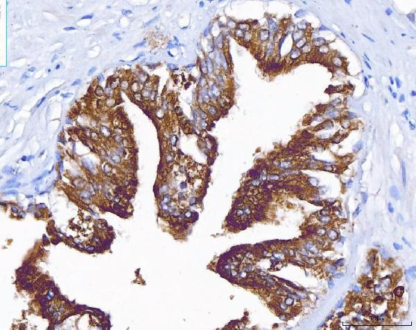 Prostate Specific Acid Phosphatase Antibody in Immunohistochemistry (Paraffin) (IHC (P))