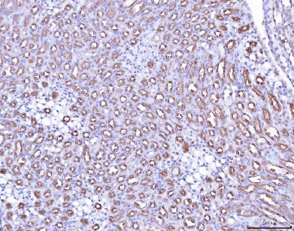 Prostate Specific Acid Phosphatase Antibody in Immunohistochemistry (Paraffin) (IHC (P))