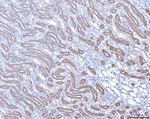 Prostate Specific Acid Phosphatase Antibody in Immunohistochemistry (Paraffin) (IHC (P))