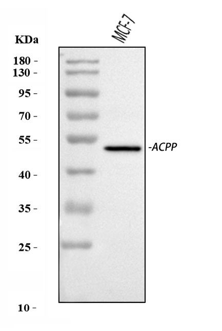 Prostate Specific Acid Phosphatase Antibody in Western Blot (WB)