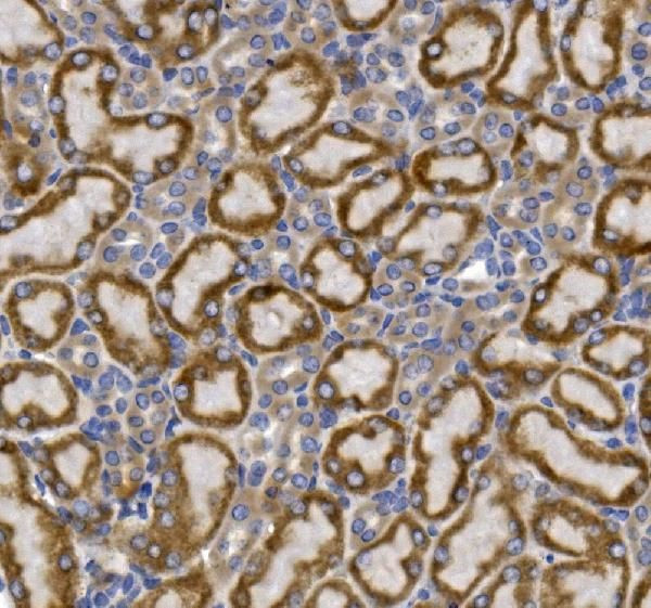 GLUT9 Antibody in Immunohistochemistry (Paraffin) (IHC (P))