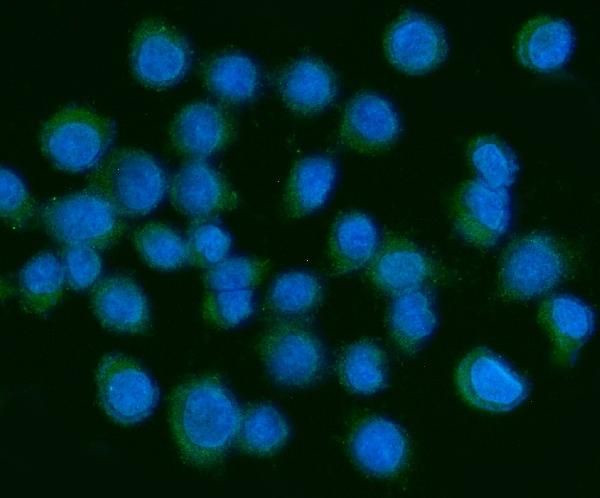 PDGF-AA Antibody in Immunocytochemistry (ICC/IF)