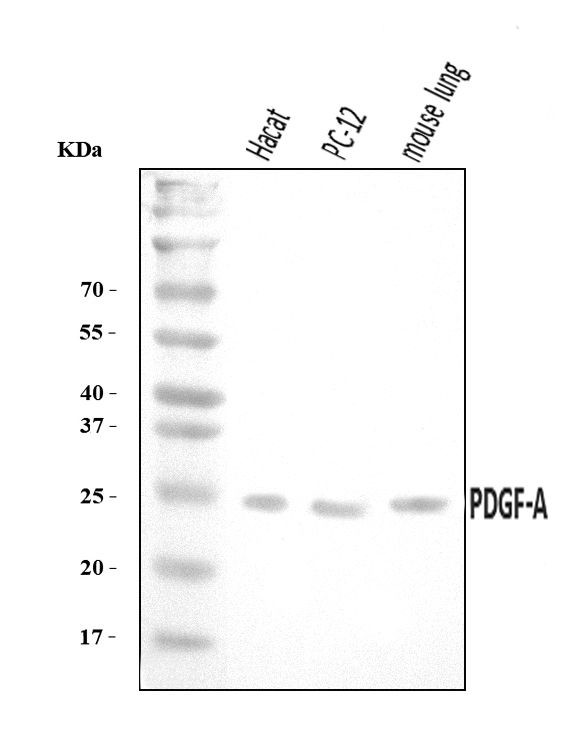 PDGF-AA Antibody in Western Blot (WB)