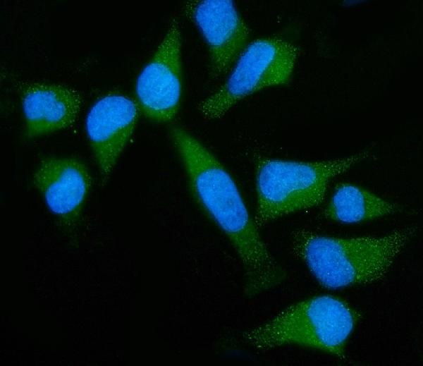 GNB3 Antibody in Immunocytochemistry (ICC/IF)