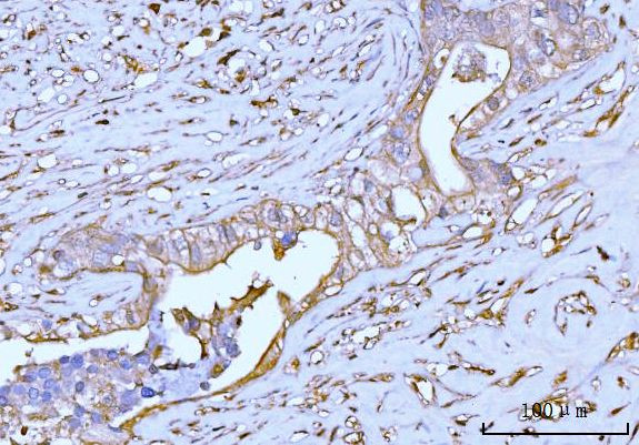 GNB3 Antibody in Immunohistochemistry (Paraffin) (IHC (P))