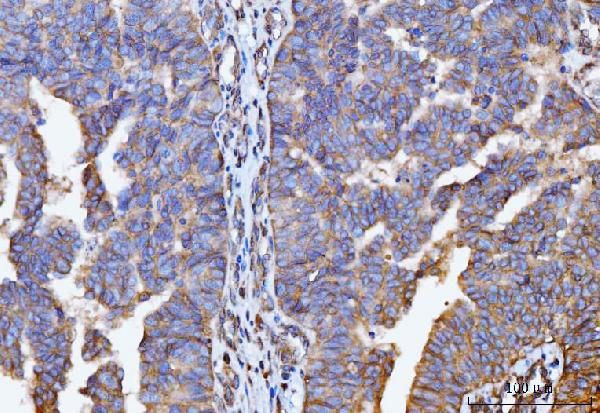 GNB3 Antibody in Immunohistochemistry (Paraffin) (IHC (P))