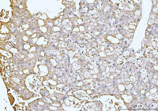 GNB3 Antibody in Immunohistochemistry (Paraffin) (IHC (P))