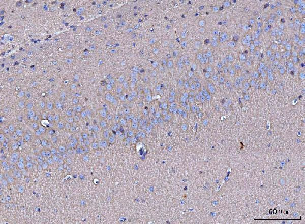 GNB3 Antibody in Immunohistochemistry (Paraffin) (IHC (P))