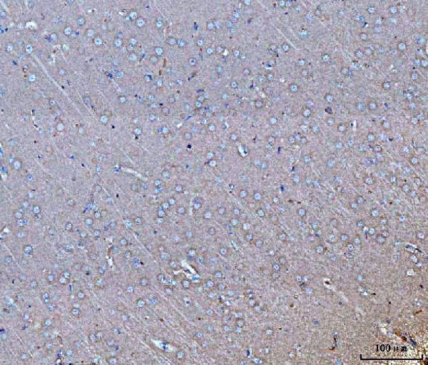 GNB3 Antibody in Immunohistochemistry (Paraffin) (IHC (P))