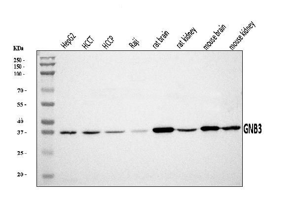 GNB3 Antibody in Western Blot (WB)