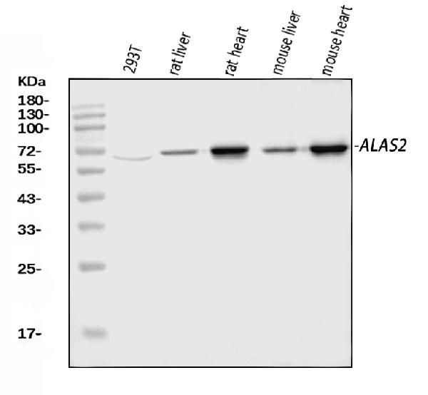 ALAS2 Antibody in Western Blot (WB)