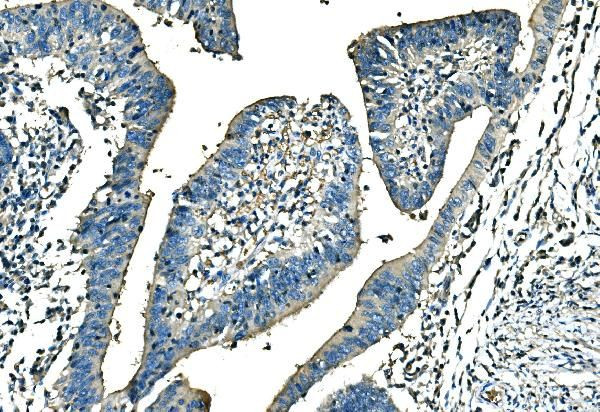 Ankyrin 1 Antibody in Immunohistochemistry (Paraffin) (IHC (P))