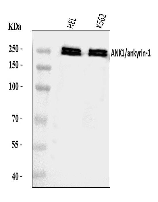 Ankyrin 1 Antibody in Western Blot (WB)