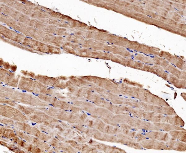 CaV1.1 Antibody in Immunohistochemistry (Paraffin) (IHC (P))