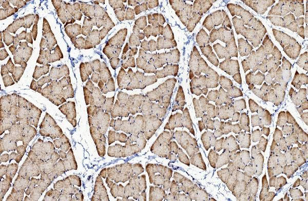 CaV1.1 Antibody in Immunohistochemistry (Paraffin) (IHC (P))