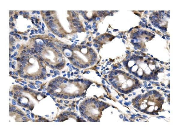 Clathrin Heavy Chain Antibody in Immunohistochemistry (Paraffin) (IHC (P))