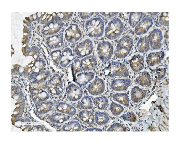 Clathrin Heavy Chain Antibody in Immunohistochemistry (Paraffin) (IHC (P))