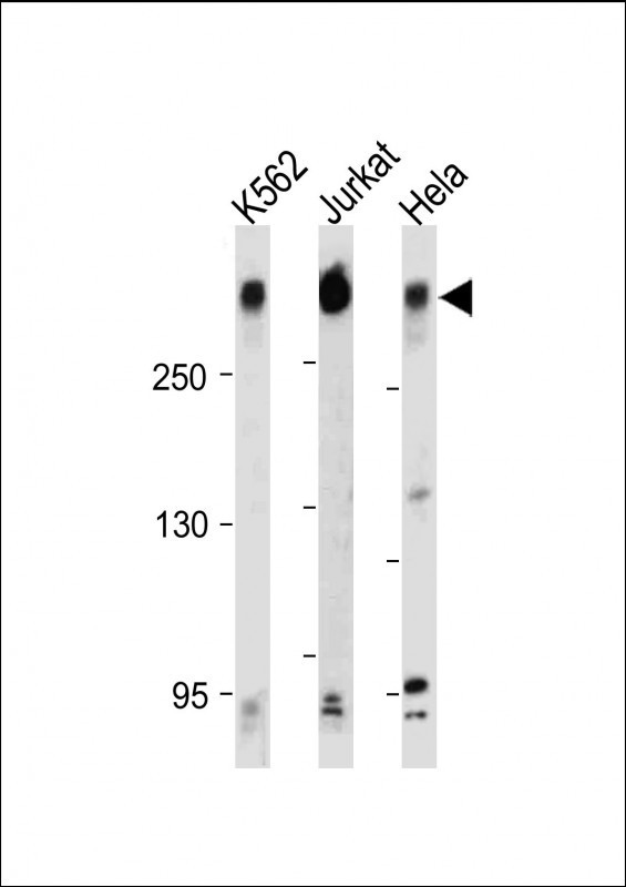 PCM1 Antibody in Western Blot (WB)