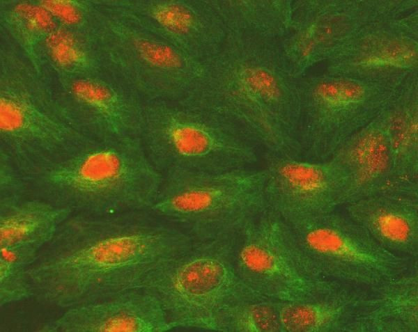 ALKBH5 Antibody in Immunocytochemistry (ICC/IF)