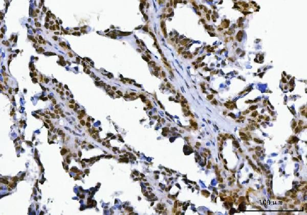 SPT5 Antibody in Immunohistochemistry (Paraffin) (IHC (P))