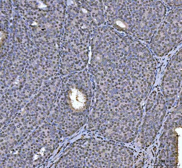 hnRNP U Antibody in Immunohistochemistry (Paraffin) (IHC (P))