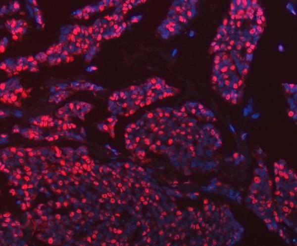 hnRNP U Antibody in Immunohistochemistry (Paraffin) (IHC (P))