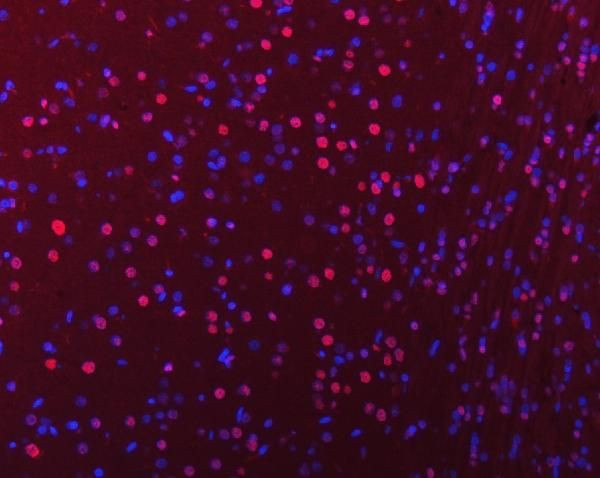 hnRNP U Antibody in Immunohistochemistry (Paraffin) (IHC (P))