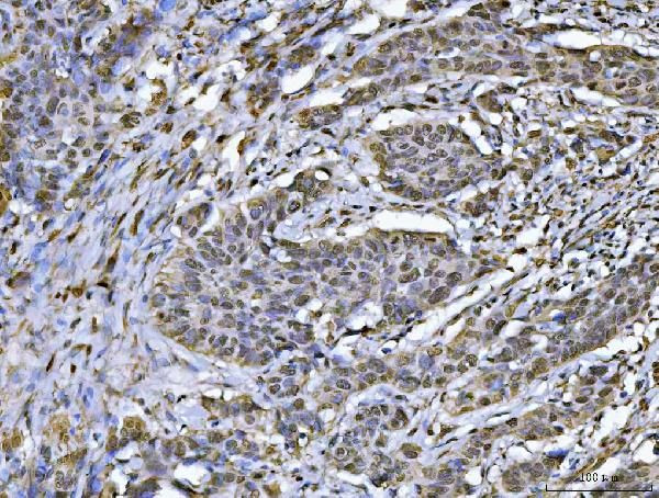 hnRNP U Antibody in Immunohistochemistry (Paraffin) (IHC (P))