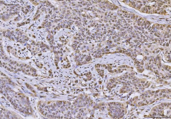 hnRNP U Antibody in Immunohistochemistry (Paraffin) (IHC (P))