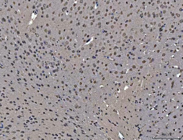 hnRNP U Antibody in Immunohistochemistry (Paraffin) (IHC (P))