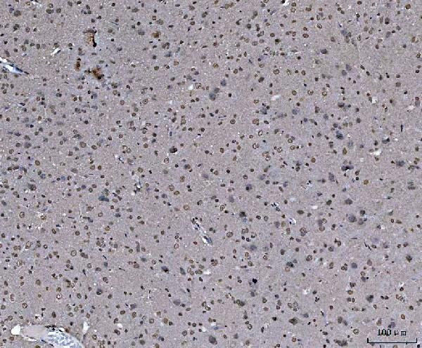 hnRNP U Antibody in Immunohistochemistry (Paraffin) (IHC (P))