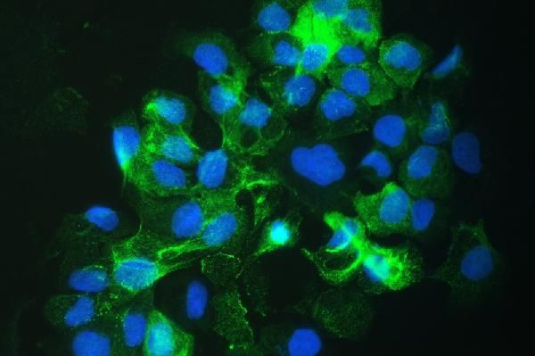 SLC34A2 Antibody in Immunocytochemistry (ICC/IF)